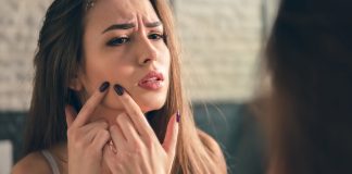 A College Girl’s Guide To Acne-Free Skin