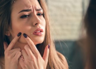 A College Girl’s Guide To Acne-Free Skin