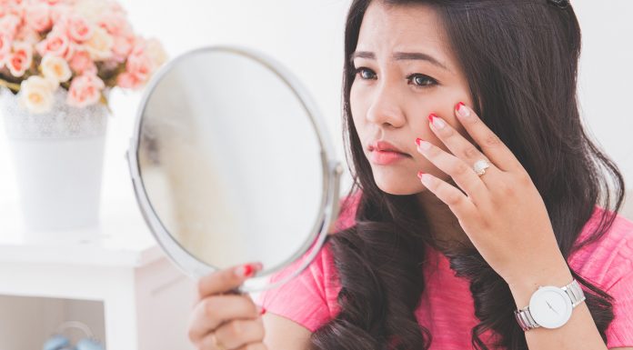 5 Tips to Keep Your Skin Acne-Free, This Monsoon