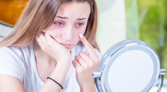 All your pore-related questions answered! All your pore-related questions, answered!