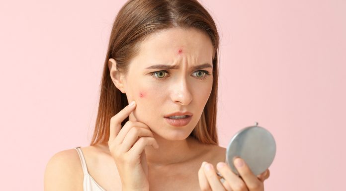 Can Face Wash Help with Pimples and Acne? Here’s the Truth