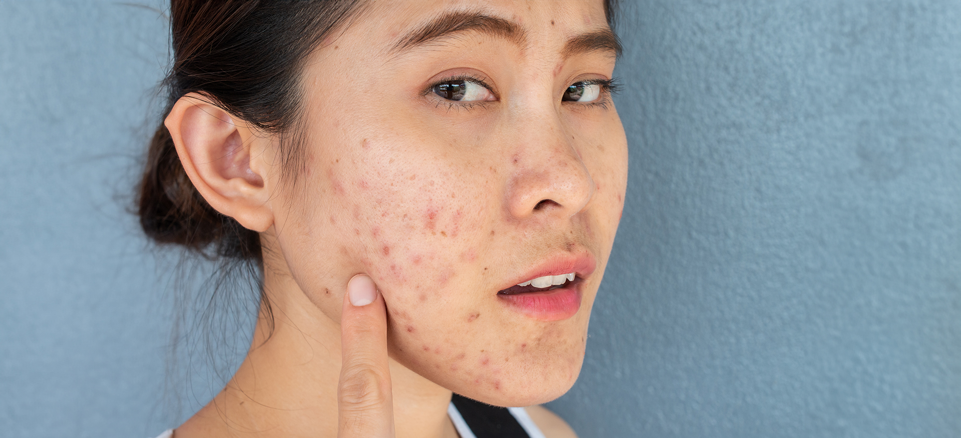 Glowing Skin on a Budget: Uses of Walnut Apricot Scrub for Skin